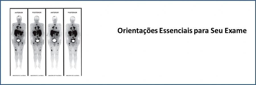 Cintilografia com Análogo da Somatostatina 