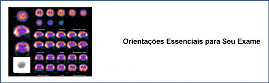 SPECT Cerebral de Perfusão